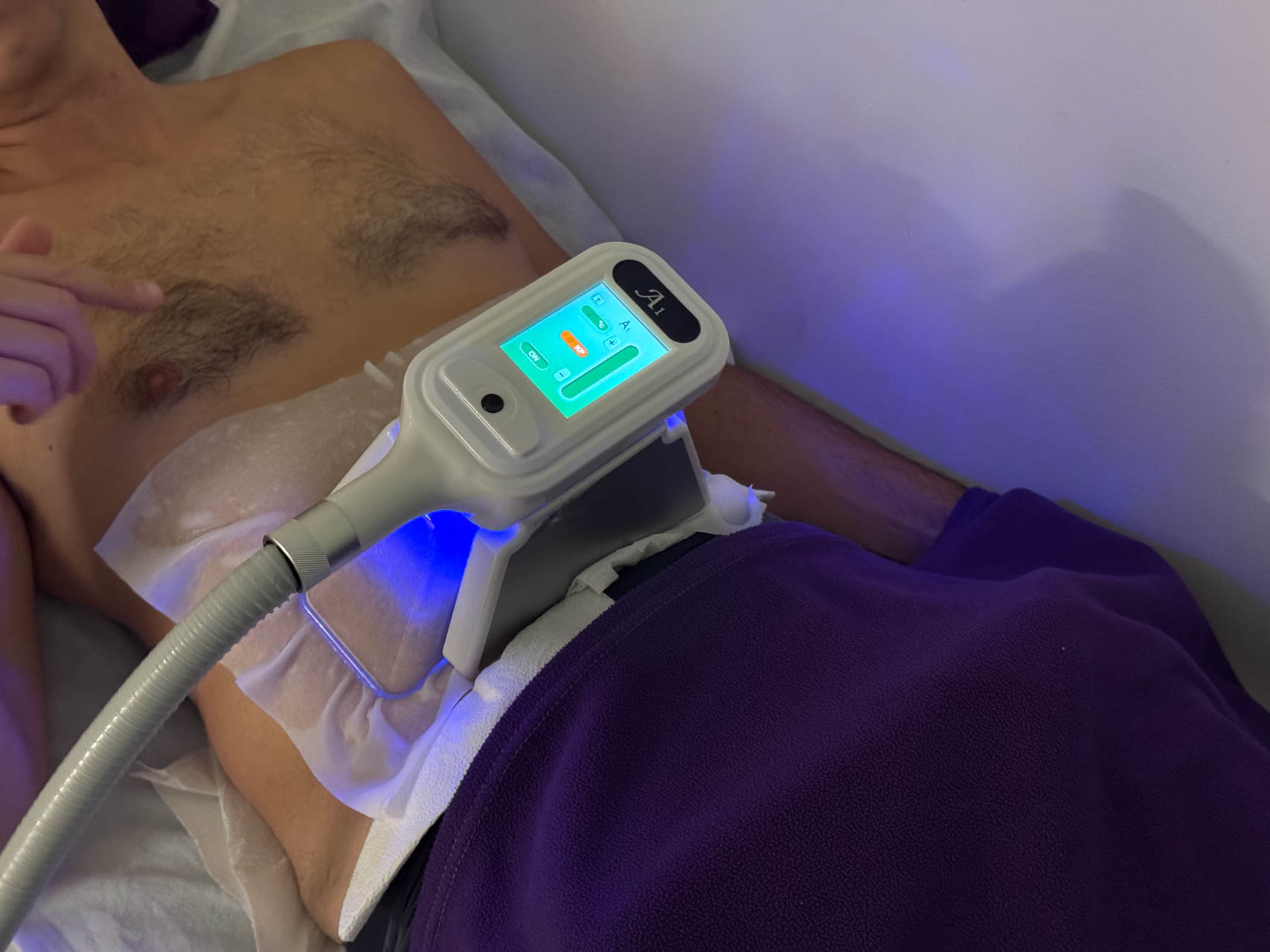 Cryolipolyse à Paris tout ce qu’il faut savoir Ligne et Endorphines — free download