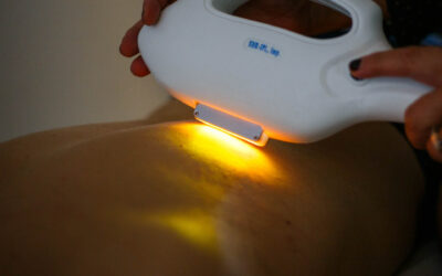 Épilation lumière pulsée comparatif : IPL à domicile vs institut vs laser