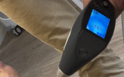 Cryothérapie localisée : bienfaits, indications, prix et contre-indications